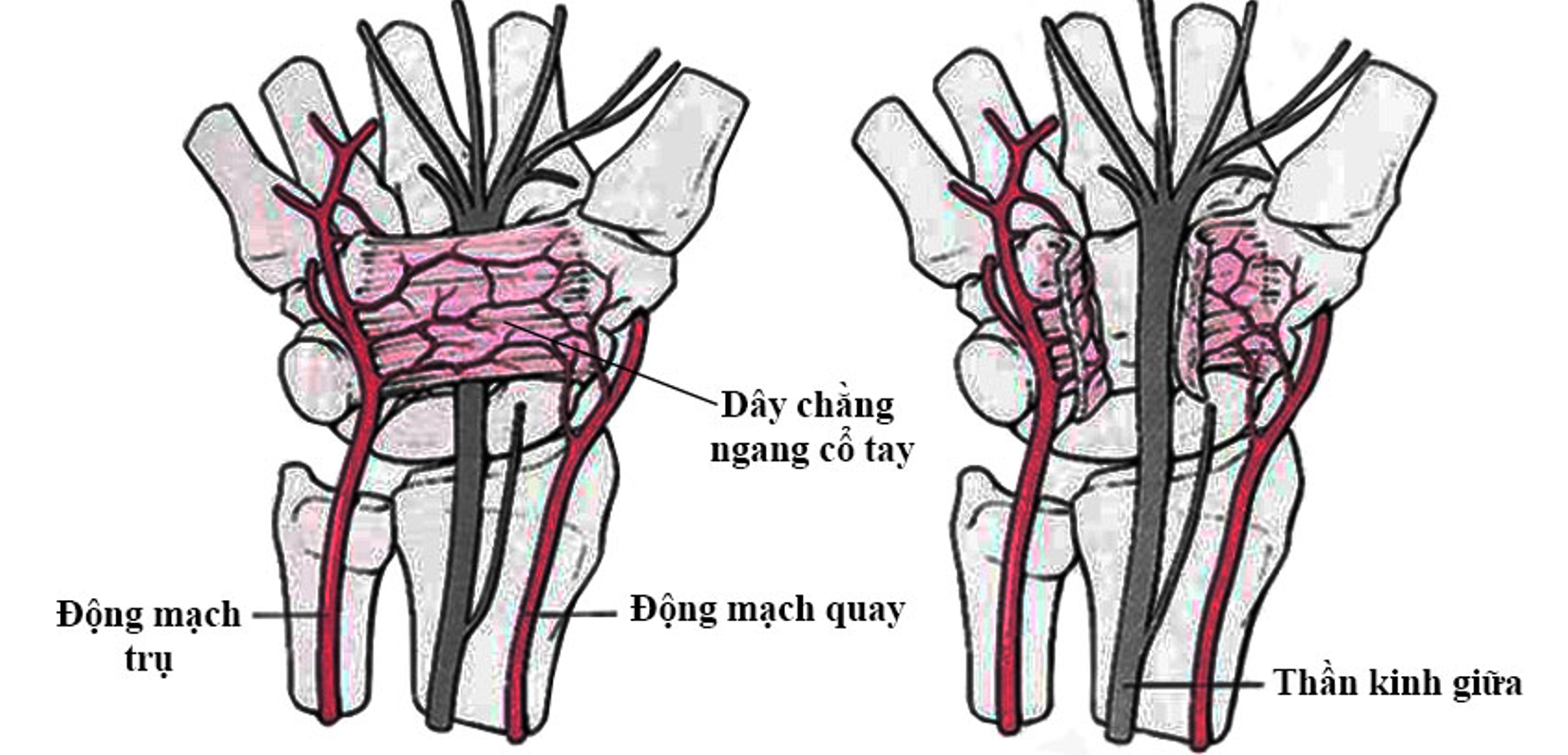Cơ chế g&acirc;y hội chứng ống cổ tay
